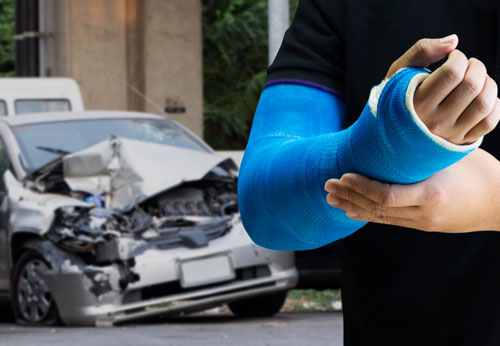 Personal Injury Lawyer, Marin County, CA